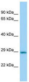Carbonyl reductase [NADPH] 2 antibody, TA344124, Origene, Western Blot image 