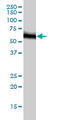 RNA Guanine-7 Methyltransferase antibody, LS-C133565, Lifespan Biosciences, Western Blot image 