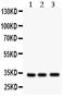 DNA-3-methyladenine glycosylase antibody, LS-C312967, Lifespan Biosciences, Western Blot image 