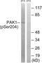 Serine/threonine-protein kinase PAK 1 antibody, PA5-37676, Invitrogen Antibodies, Western Blot image 