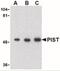 Golgi Associated PDZ And Coiled-Coil Motif Containing antibody, NBP1-77242, Novus Biologicals, Western Blot image 