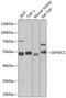 Sep (O-Phosphoserine) TRNA:Sec (Selenocysteine) TRNA Synthase antibody, 22-701, ProSci, Western Blot image 