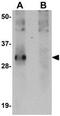 Synaptophysin Like 2 antibody, GTX85272, GeneTex, Western Blot image 