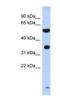 Serine Protease 48 antibody, NBP1-70689, Novus Biologicals, Western Blot image 