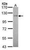 RB Binding Protein 8, Endonuclease antibody, orb89985, Biorbyt, Western Blot image 
