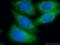 Glycerol-3-Phosphate Acyltransferase 3 antibody, 20603-1-AP, Proteintech Group, Immunofluorescence image 