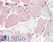 X-Linked Kx Blood Group antibody, LS-B3401, Lifespan Biosciences, Immunohistochemistry paraffin image 