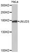 Lysine Demethylase 6B antibody, STJ111827, St John