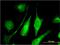 Adenylate Kinase 9 antibody, MA5-23189, Invitrogen Antibodies, Immunofluorescence image 