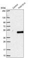 Family With Sequence Similarity 181 Member A antibody, PA5-51611, Invitrogen Antibodies, Western Blot image 