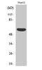 Acrosin Binding Protein antibody, A12806-1, Boster Biological Technology, Western Blot image 