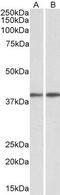 G Protein Subunit Alpha Q antibody, TA311219, Origene, Western Blot image 