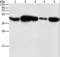 Phosphoglycerate kinase 2 antibody, LS-C404628, Lifespan Biosciences, Western Blot image 