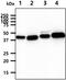 Chitinase 3 Like 2 antibody, GTX57710, GeneTex, Western Blot image 