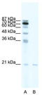 SCAN Domain Containing 1 antibody, TA339492, Origene, Western Blot image 