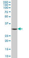 2,4-Dienoyl-CoA Reductase 1 antibody, LS-C133880, Lifespan Biosciences, Western Blot image 