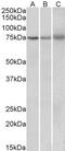 Kelch Like Family Member 6 antibody, GTX88252, GeneTex, Western Blot image 