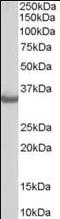 STIP1 homology and U box-containing protein 1 antibody, orb95299, Biorbyt, Western Blot image 
