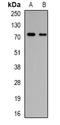 Polypeptide N-Acetylgalactosaminyltransferase 3 antibody, orb341121, Biorbyt, Western Blot image 