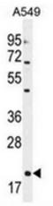 Endothelin-1 antibody, AP51364PU-N, Origene, Western Blot image 
