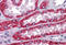 Receptor Interacting Serine/Threonine Kinase 1 antibody, MBS244907, MyBioSource, Immunohistochemistry frozen image 