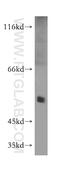 Peroxisome Proliferator Activated Receptor Delta antibody, 10156-2-AP, Proteintech Group, Western Blot image 