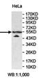 Amyloid Beta Precursor Protein Binding Family B Member 3 antibody, orb78335, Biorbyt, Western Blot image 
