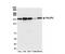 PH Domain And Leucine Rich Repeat Protein Phosphatase 2 antibody, NB100-1812, Novus Biologicals, Western Blot image 