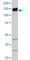 TOP1 Binding Arginine/Serine Rich Protein antibody, LS-B4493, Lifespan Biosciences, Western Blot image 