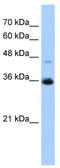 Geranylgeranyl Diphosphate Synthase 1 antibody, TA346696, Origene, Western Blot image 