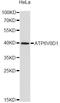 ATPase H+ Transporting V0 Subunit D1 antibody, A4271, ABclonal Technology, Western Blot image 