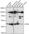 Zinc Finger And BTB Domain Containing 6 antibody, A15136, ABclonal Technology, Western Blot image 