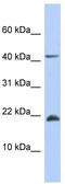 SREK1 Interacting Protein 1 antibody, TA331423, Origene, Western Blot image 