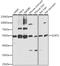 Sterol O-acyltransferase 1 antibody, A05096, Boster Biological Technology, Western Blot image 