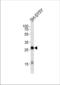 Glycoprotein M6A antibody, TA325101, Origene, Western Blot image 