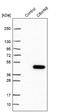 Chromosome 8 Open Reading Frame 48 antibody, NBP1-93917, Novus Biologicals, Western Blot image 