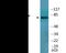 Microtubule Associated Protein Tau antibody, EKC2530, Boster Biological Technology, Western Blot image 