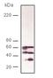 Serine/threonine-protein phosphatase 2B catalytic subunit beta isoform antibody, A07303, Boster Biological Technology, Western Blot image 