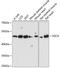 Sarcoglycan Alpha antibody, GTX66435, GeneTex, Western Blot image 