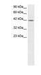 Nuclear Trans. Factor Y alpha-1 antibody, PA1-24431, Invitrogen Antibodies, Western Blot image 