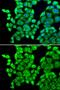 Eukaryotic Translation Elongation Factor 1 Delta antibody, GTX55601, GeneTex, Immunocytochemistry image 