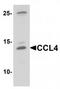 C-C Motif Chemokine Ligand 4 antibody, TA319702, Origene, Western Blot image 