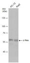 Proto-oncogene tyrosine-protein kinase Yes antibody, GTX100616, GeneTex, Western Blot image 