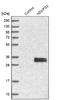 NADH:Ubiquinone Oxidoreductase Core Subunit S3 antibody, NBP1-85619, Novus Biologicals, Western Blot image 