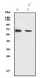 Matrix Metallopeptidase 2 antibody, A00286-2, Boster Biological Technology, Western Blot image 