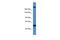Transcription Factor 20 antibody, A06679, Boster Biological Technology, Western Blot image 