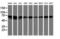 Dynein Axonemal Assembly Factor 1 antibody, M09808-1, Boster Biological Technology, Western Blot image 