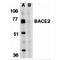 Beta-secretase 2 antibody, MBS150389, MyBioSource, Western Blot image 