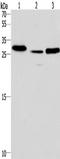Interleukin 1 Receptor Associated Kinase 1 Binding Protein 1 antibody, TA349366, Origene, Western Blot image 
