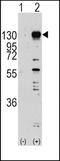 Fibroblast Growth Factor Receptor 1 antibody, TA302062, Origene, Western Blot image 